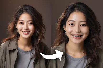 AI Braces Filter Online