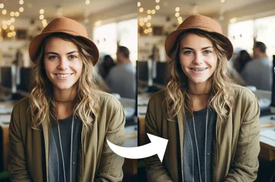 Free AI Braces Filter