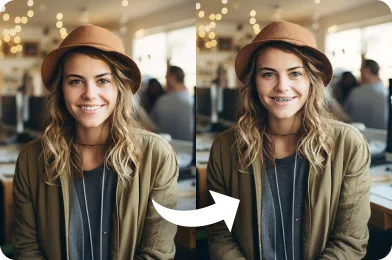 AI Braces Filter